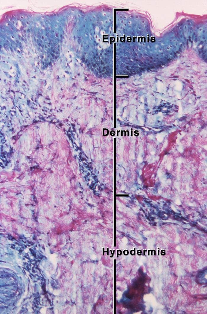 A microscope image showing the layered structure of normal human skin tissue